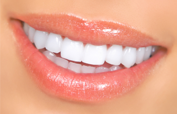 Perfect smile of a woman after professional teeth whitening treatment.